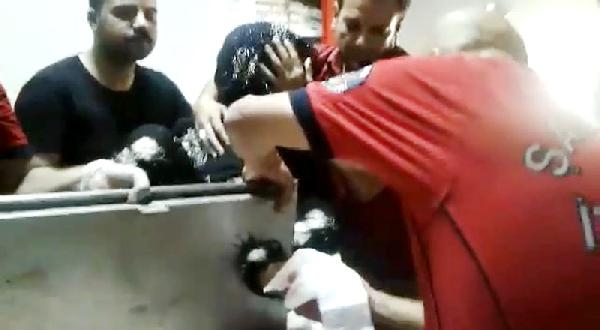 Elini kıyma makinesine kaptırdı Elini kıyma makinesine kaptırdı