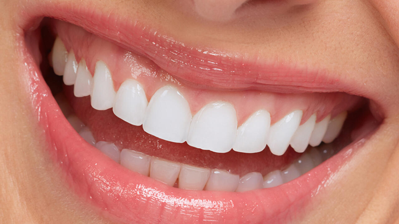 Yaprak Porselen (Lamina) nedir? 6