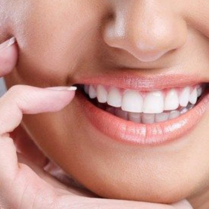 Yaprak Porselen (Lamina) nedir? 7
