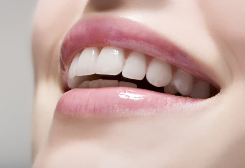 Yaprak Porselen (Lamina) nedir? 8
