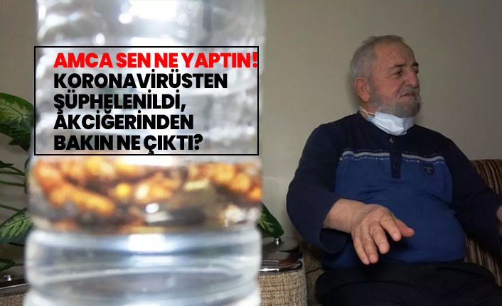 Koronavirüsten  şüphelenildi,  akciğerinden  bakın ne çıktı?