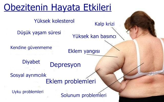 Obezite Bir Çok Hastalığa Davetiye Çıkarıyor