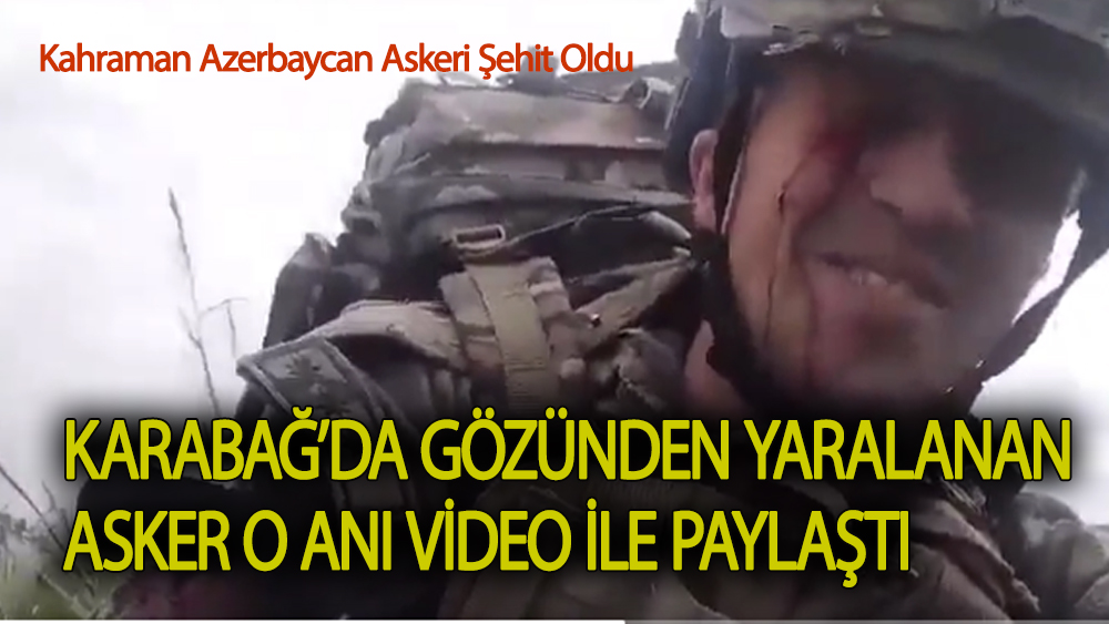 Karbağ'da gözünden yaralanan asker o anı paylaştı