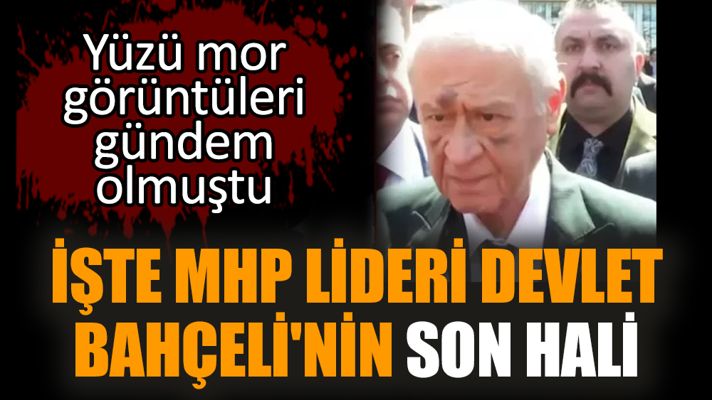 İşte MHP lideri Devlet Bahçeli'nin son hali