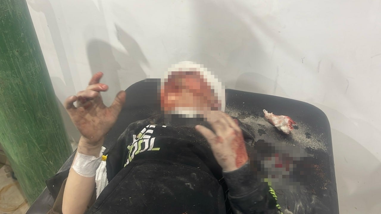 İsrail'in Gazze'ye Yönelik Saldırısında Can Kaybı 230'u Aştı