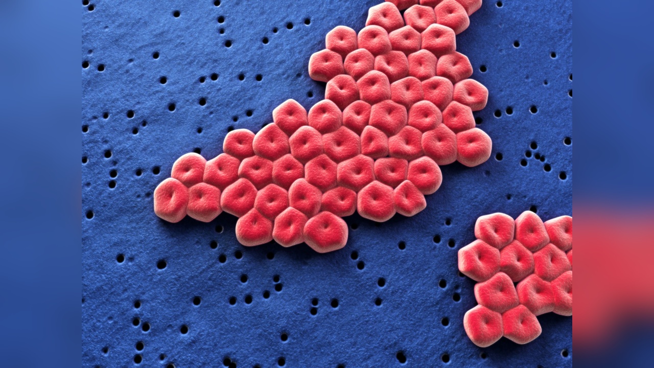 Antibiyotik Dirençli Süper Bakteri Keşfedildi
