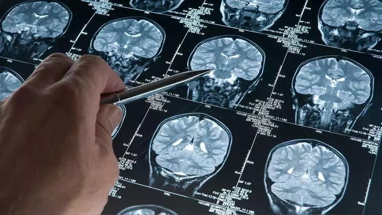 Yeni Uyku İlaçları Alzheimer Riskini Azaltabilir