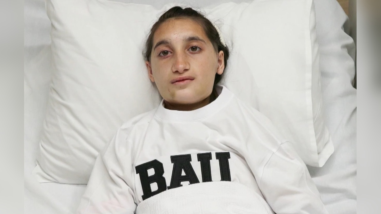 Gürcü Kız Çocuğu Mariam, Türkiye'de Tedavi Edildi