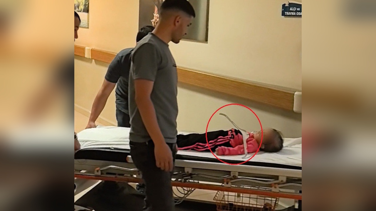 İki Yaşındaki Meryem'in Oynarken Düşmesiyle Askı Çenesine Saplandı