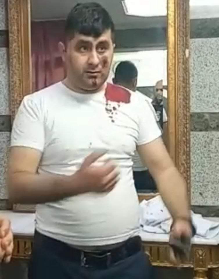 azerbaycan saldırı