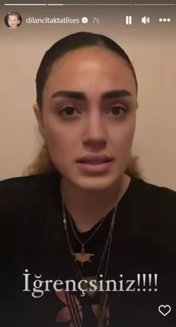 dilan tatlıses