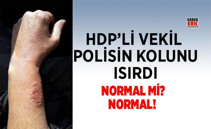 Hdp Li Vekil Kadin Polis Memurunun Kolunu Isirdi Takvim