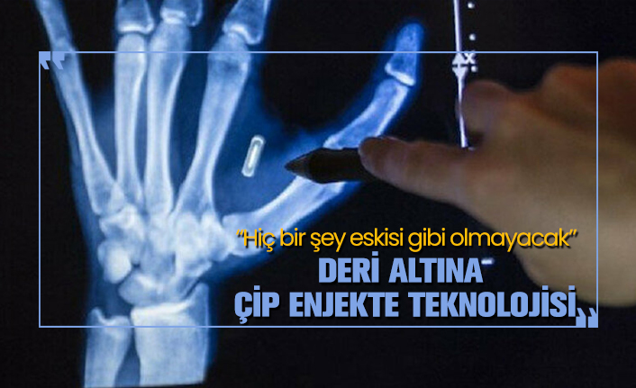 Deri altına çip enjekte teknolojisi