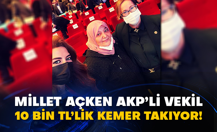 Millet açken AKP’li vekil 10 bin TL’lik kemer takıyor!
